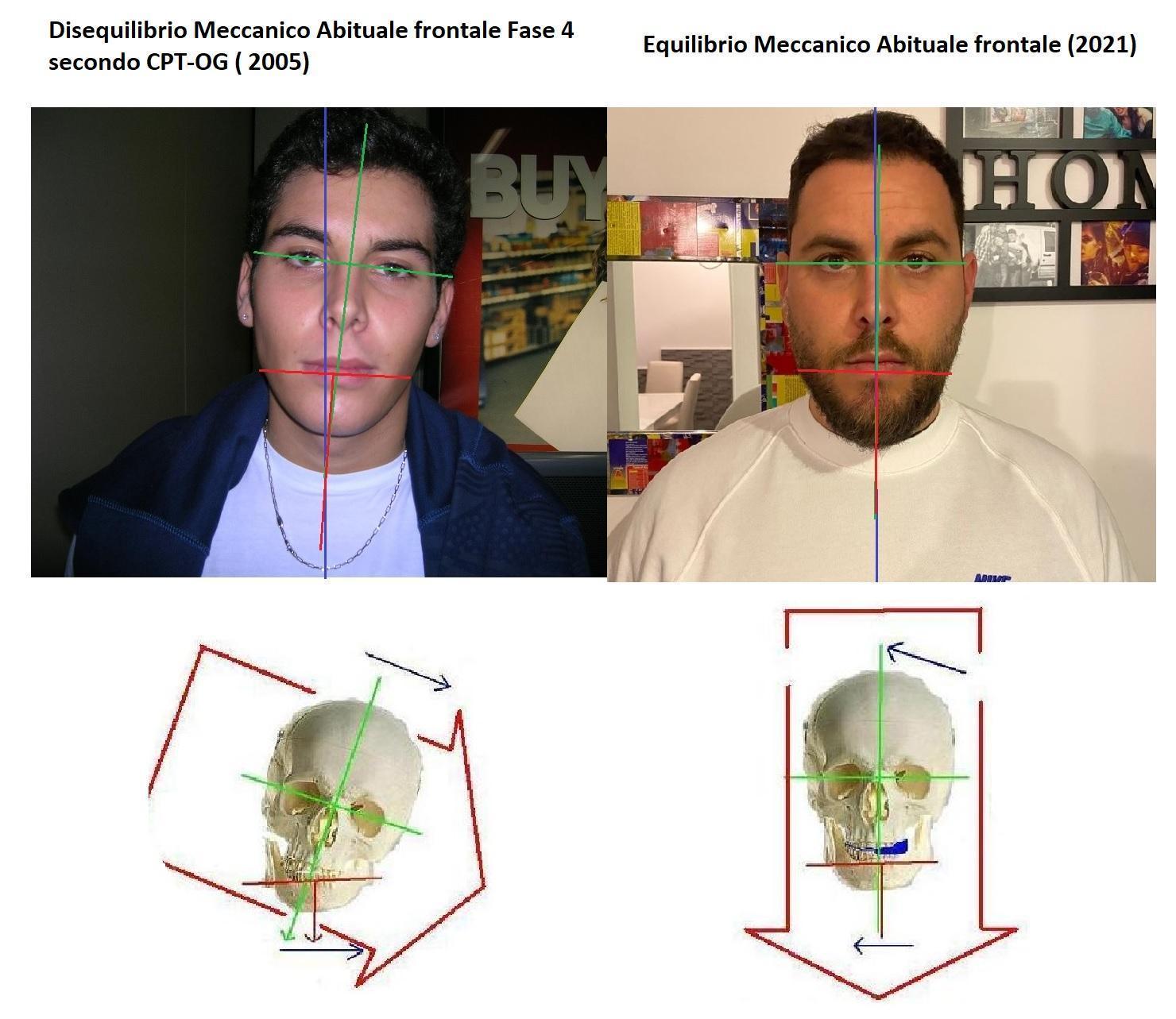 Perché scegliere Concept OG invece di un trattamento tradizionale?