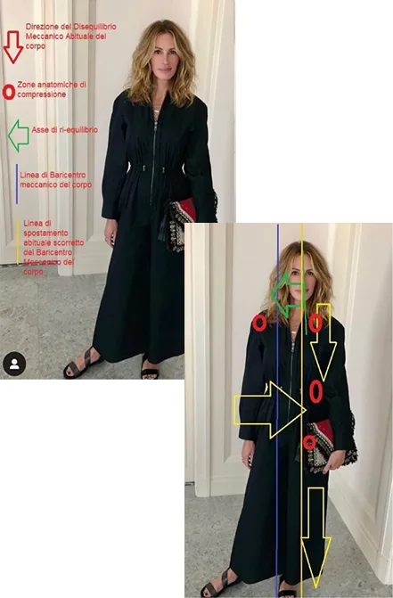 Differenza tra posture