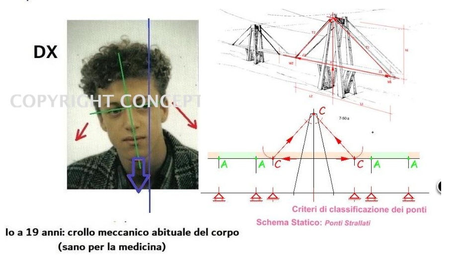 Massaggi, trattamenti ed esercizi posturali: nel 99% dei casi sono sbagliati. Perchè?